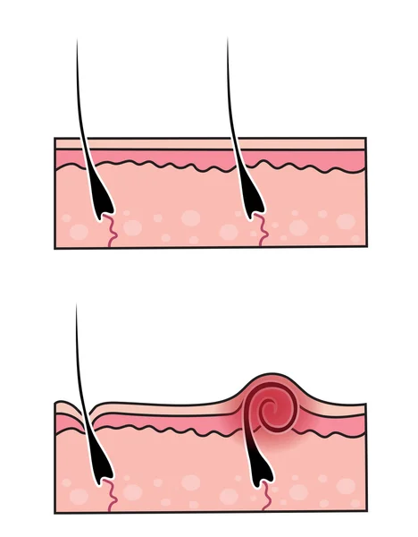 Conjunto de pelo excavado — Archivo Imágenes Vectoriales