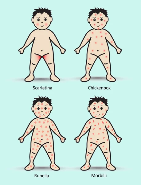 아기 발진, 피부 발진 — 스톡 벡터