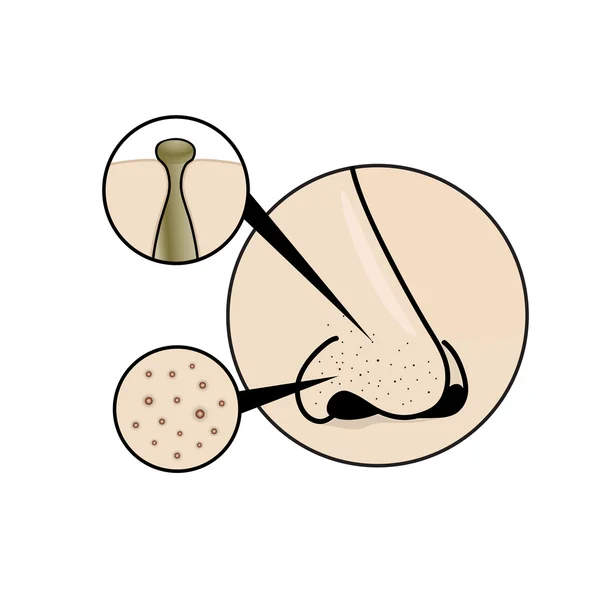 Zwarte nouse — Stockvector