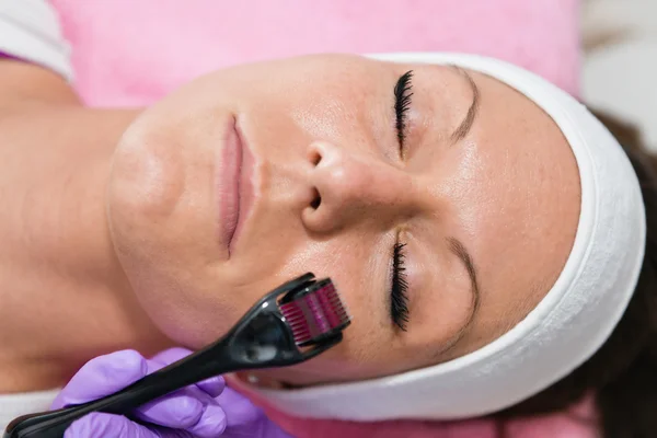 Tratamiento facial de Dermaroller — Foto de Stock