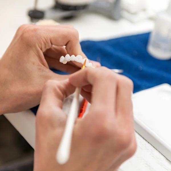 Dentist working with tooth dentures — Stock Photo, Image