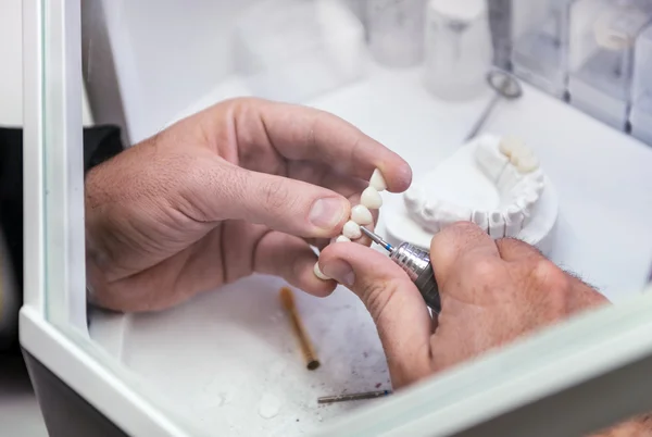 Zubař pracuje s zubní protézy — Stock fotografie