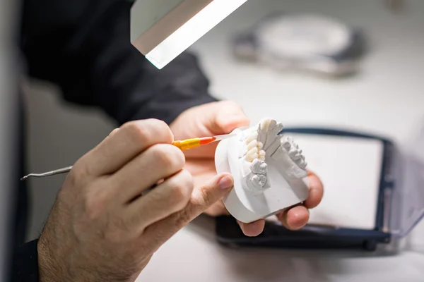 Dental technician working with tooth dentures — Stock Photo, Image