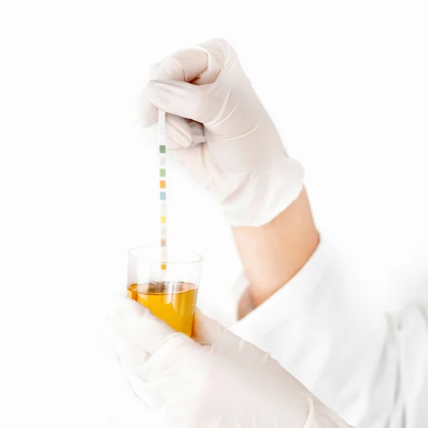 Analyse van de monsteroplossing urine — Stockfoto