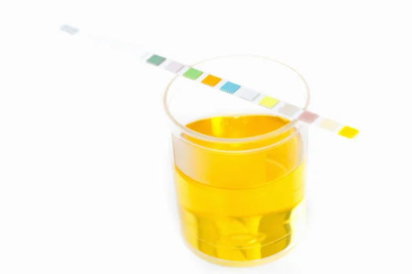 Urine sample and test strip — Stock Photo, Image