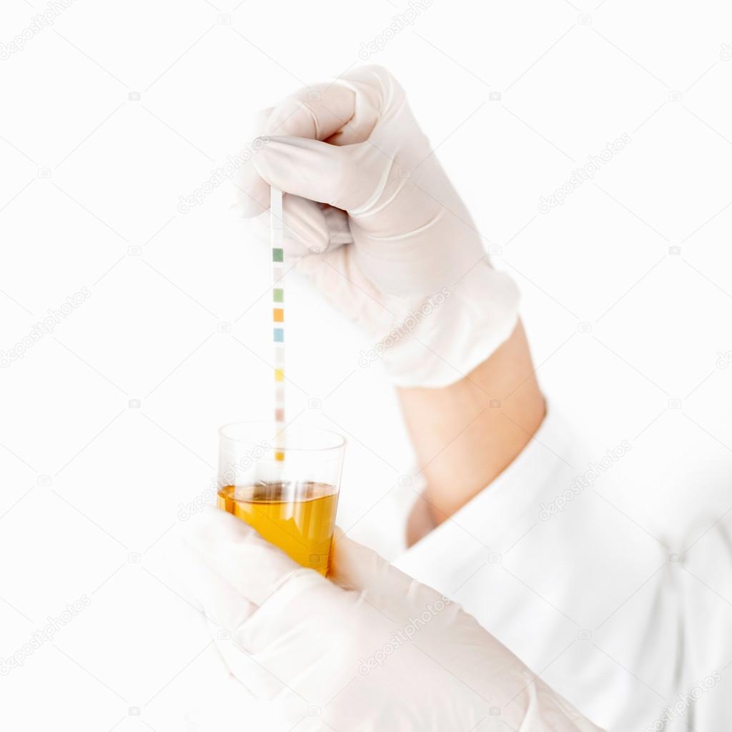 Analyzing urine sample