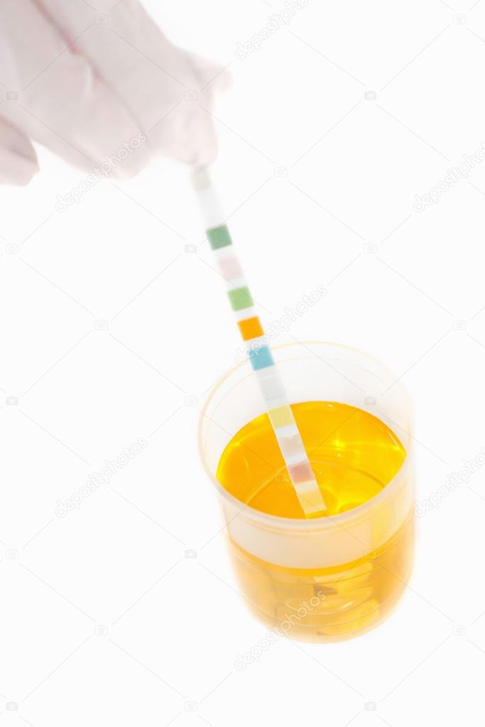 Urine sample analysis