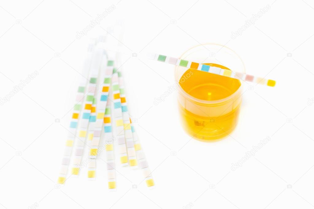 Urine sample and test strips