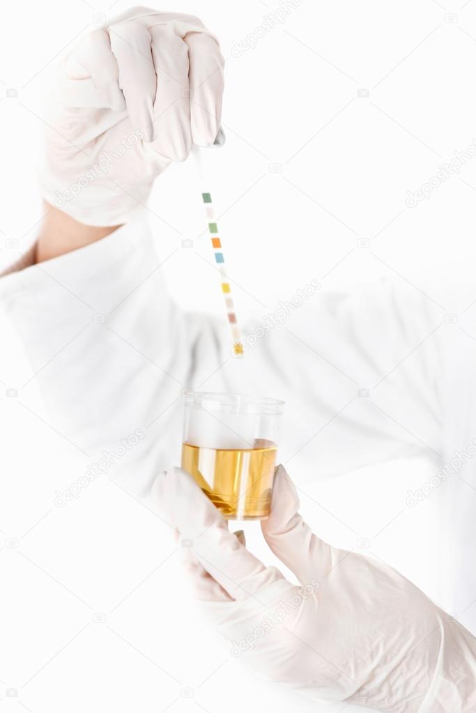 Medical worker testing urine sample