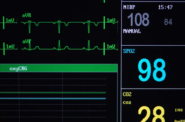 Monitor de soporte vital — Foto de Stock