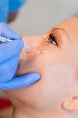 Hyaluronan enjeksiyon doldurma