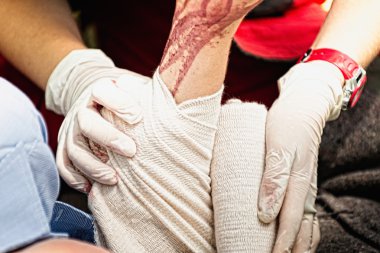 Kanlı kolunda sargı koyarak