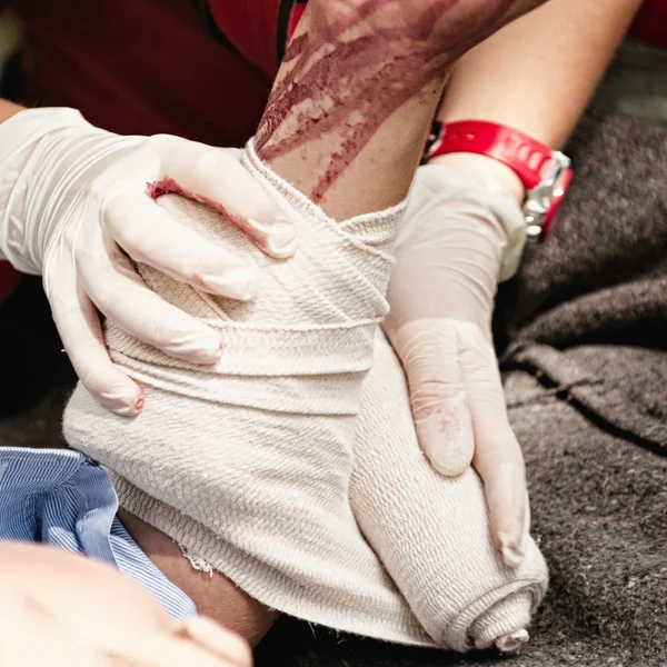 Poner vendaje en el brazo ensangrentado — Foto de Stock