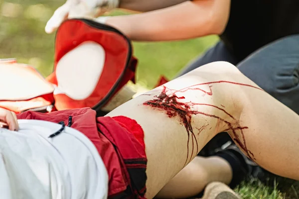 Paramédico abordando ferimentos graves nas pernas — Fotografia de Stock