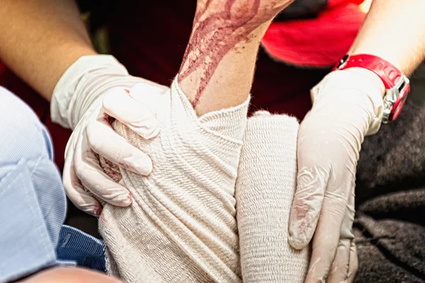 Poner vendaje en el brazo ensangrentado — Foto de Stock