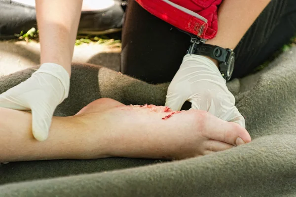 Sjukvårdare adressering skadade foten — Stockfoto