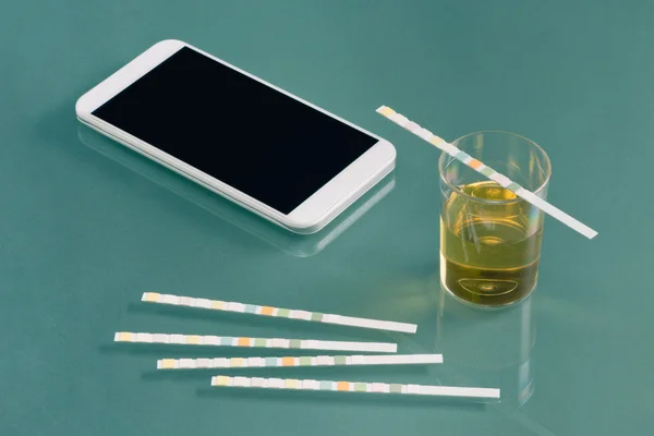 Amostra de urina e smartphone — Fotografia de Stock