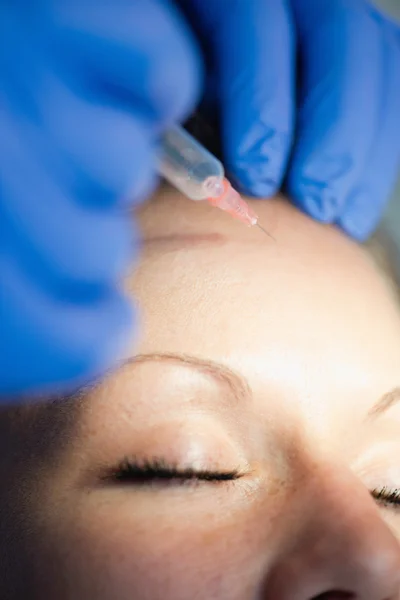 Botox injeção na testa da mulher — Fotografia de Stock