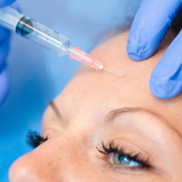 Botox injectie op vrouw voorhoofd — Stockfoto