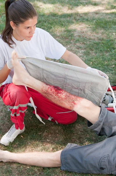 Paramedische behandeling van een slachtoffer met derdegraads brandwonden — Stockfoto