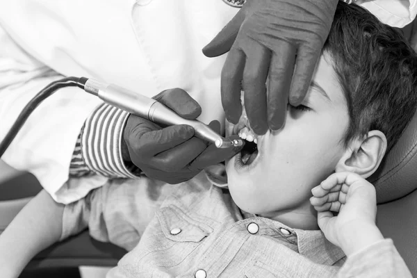 Dentista Removendo Cálculo Dental para Menino — Fotografia de Stock