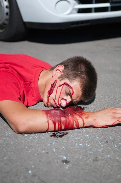 躺在街道上的汽车事故受害者 — 图库照片