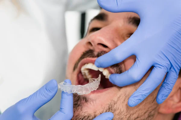 Placing invisible braces to patient mouth — Stock Photo, Image