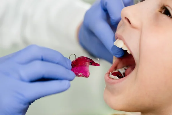 Tjej får dental hängslen — Stockfoto