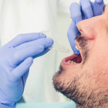 Görünmez diş telleri yerleştirerek ortodontist 