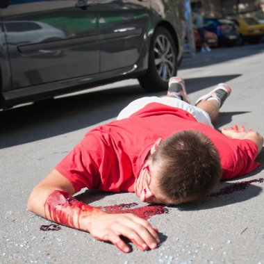 Car accident victim lying on street clipart