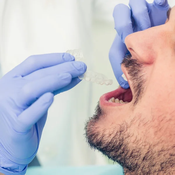Orthodontist plaatsen onzichtbare beugels — Stockfoto