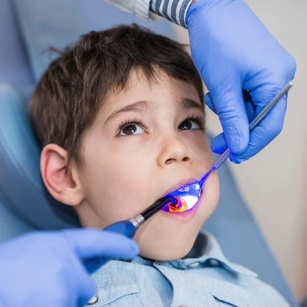Dentysta suszenia chłopiec zęba — Zdjęcie stockowe