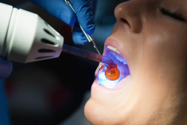 Dentist preparing patient for filling — Stock Photo, Image