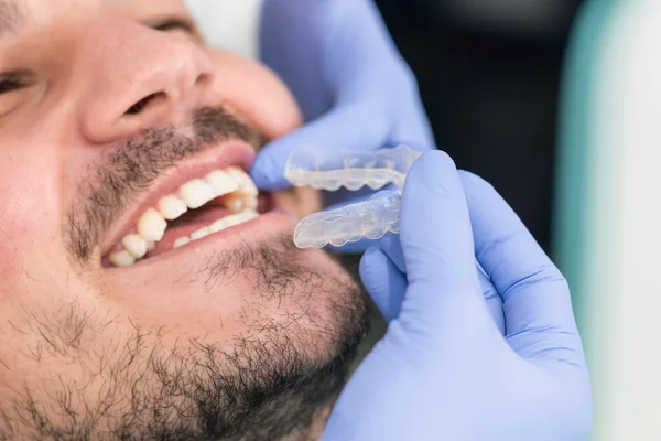 Placing invisible braces to patient — Stock Photo, Image