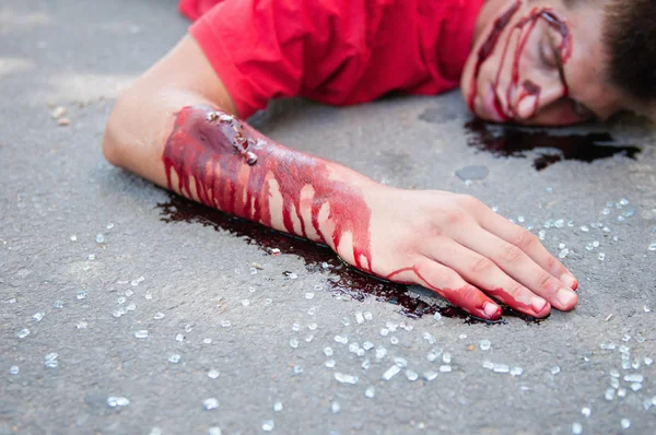 Boy with broken arm after car accident — Stock Photo, Image