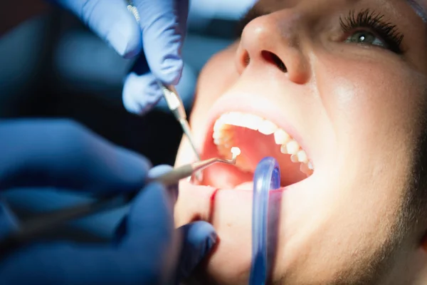 Tandläkare gör tandvård fyllning tand — Stockfoto