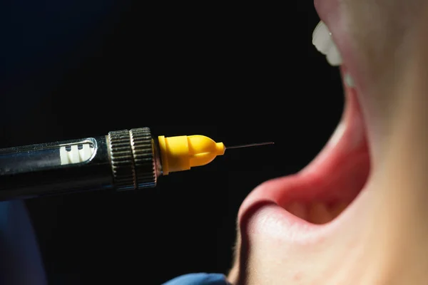 Application of dental anesthesia — Stock Photo, Image