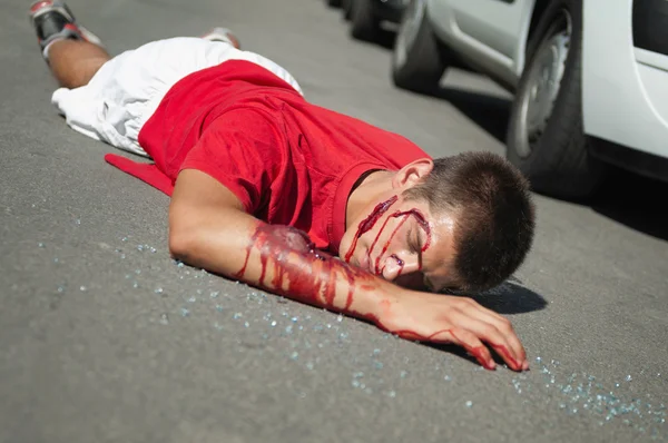 Vítima de acidente de carro deitado na rua — Fotografia de Stock