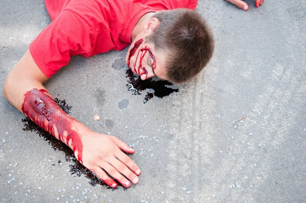 Slachtoffer van een verkeersongeval op straat liggen — Stockfoto