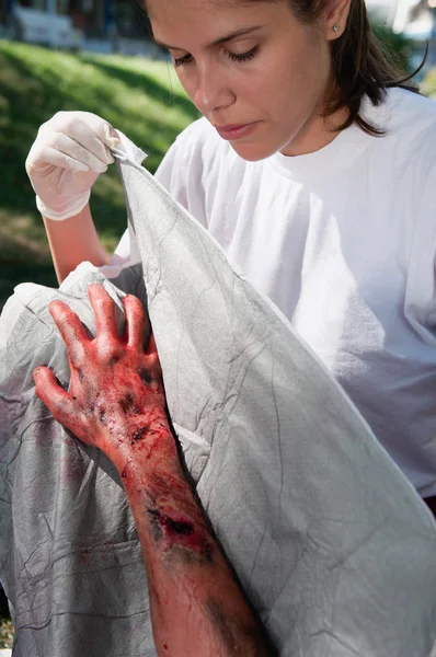 Sanitäter behandeln Opfer mit Verbrennungen dritten Grades — Stockfoto