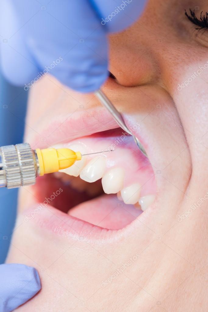 Application of dental anesthesia Stock Photo by ©microgen 115990096