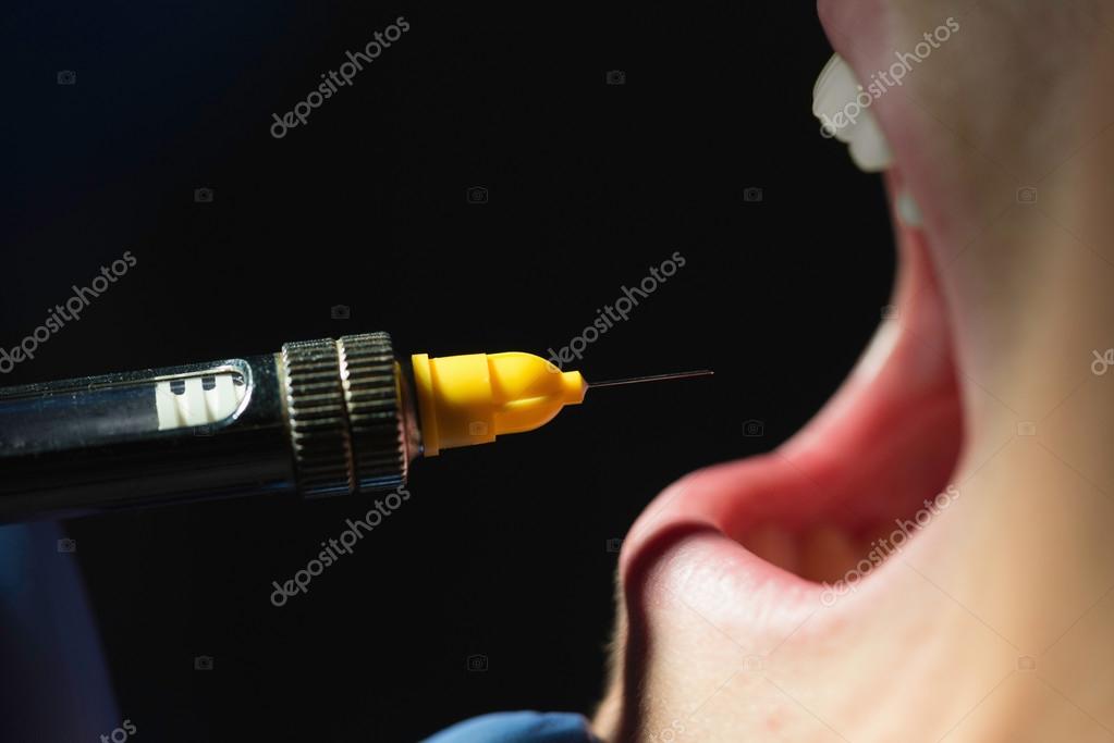 Application of dental anesthesia Stock Photo by ©microgen 115992684