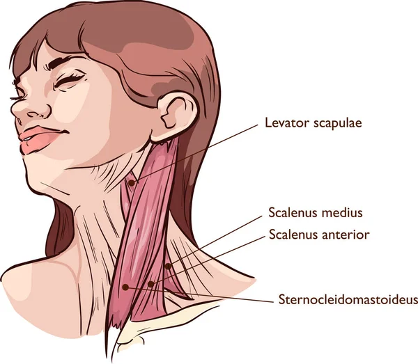 Vector Illustration Neck Muscles Anatomy — Stock Vector