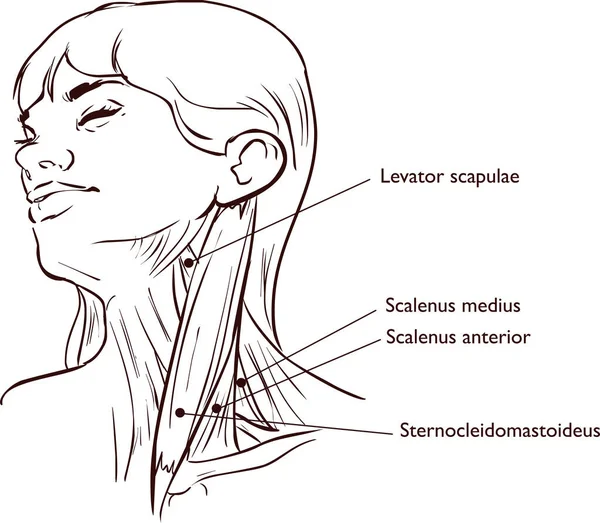 Vector Illustration Neck Muscles Anatomy — Stock Vector