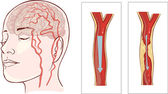 Gehirn Anatomie Diagramm mit Schnitt in verschiedenen Farben und benannt