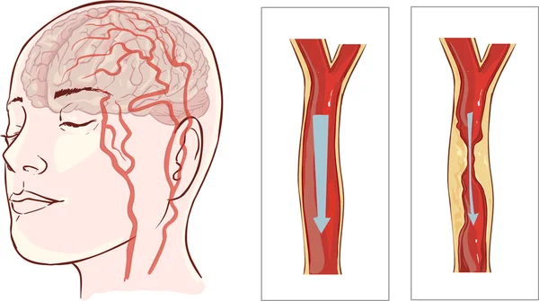 Diagramme d'anatomie cérébrale avec sectionné en différentes couleurs et nommé — Image vectorielle