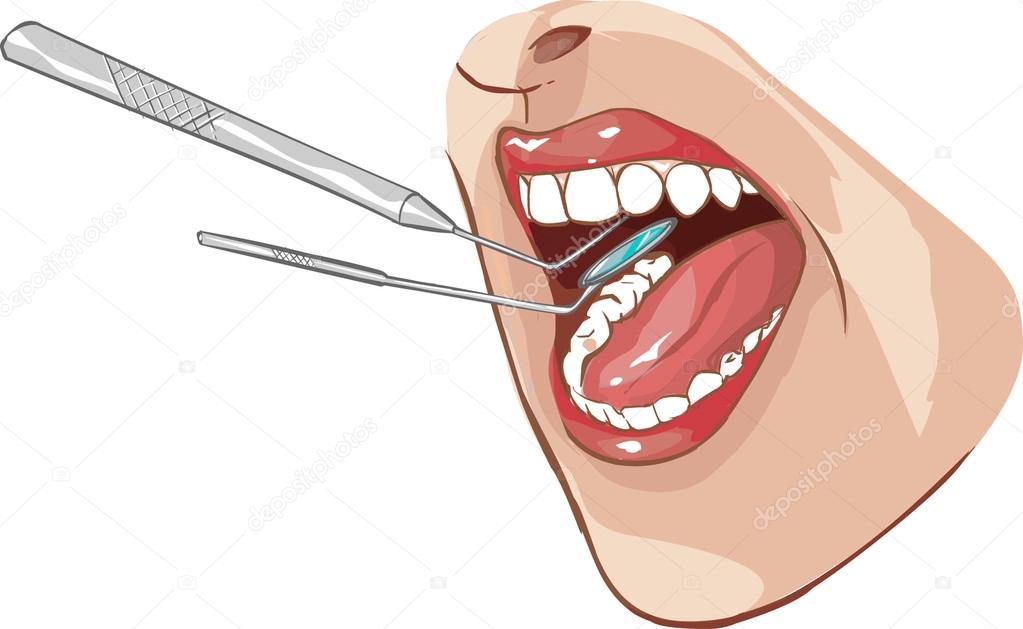 dental examination illustration