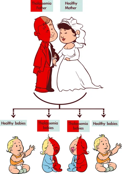 Thalassemia 특성 infographic — 스톡 벡터