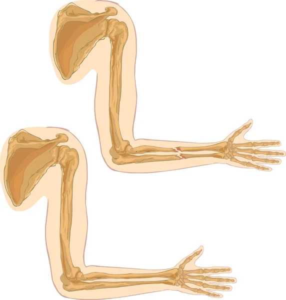 矢量图的肱骨 — 图库矢量图片
