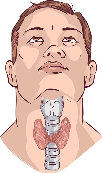 Vector Thyroid gland and larynx — Stock Vector